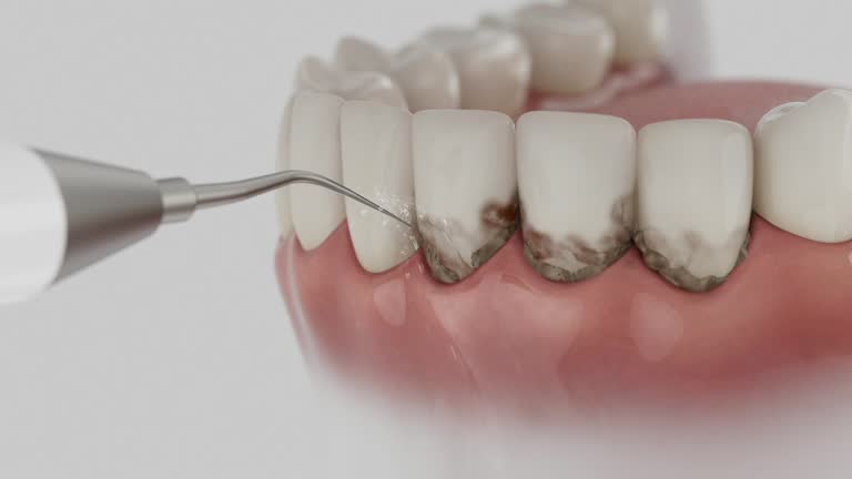 Trusted Teeth Cleaning And Checkup service in Eden Isle, LA - Dentist Open Now